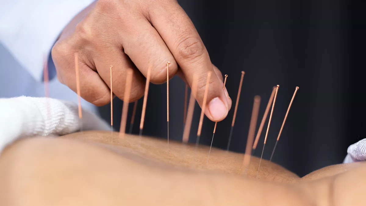 Akupunktur Endikasyonları